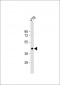 GNAT2 Antibody (Center)
